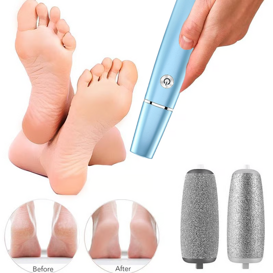 💥Zeitlich begrenztes Angebot 80 % RABATT🔥⚡Elektrischer Hornhautentferner für die Füße
